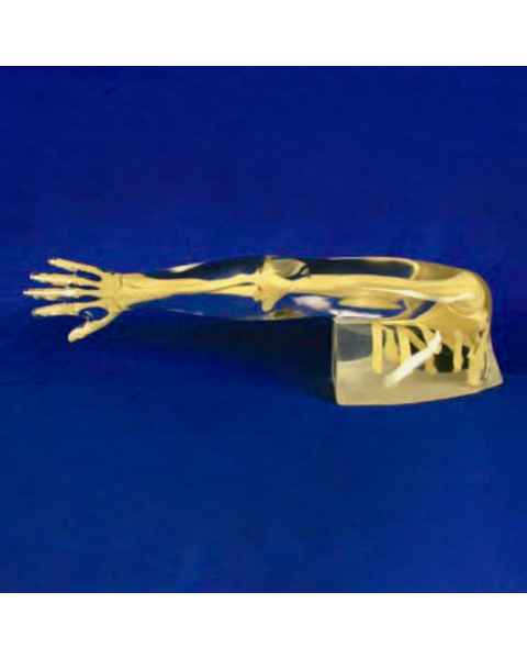 RSD Anthropomorphic Complete Arm Shoulder Phantom