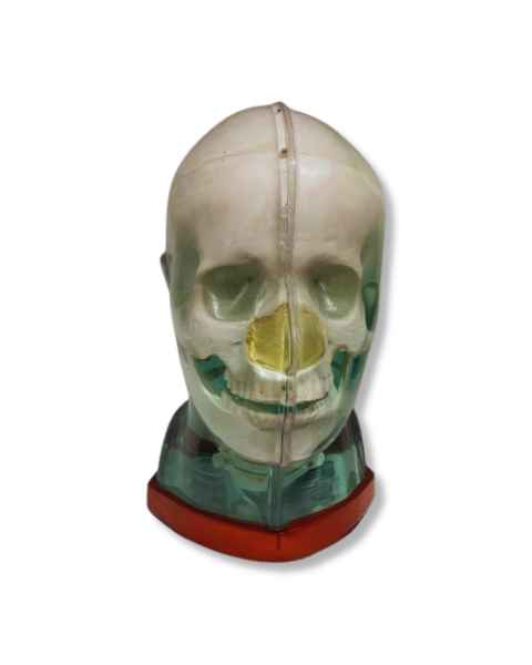 RSD RS-MMH Multi-Modality Fusion Head Phantom