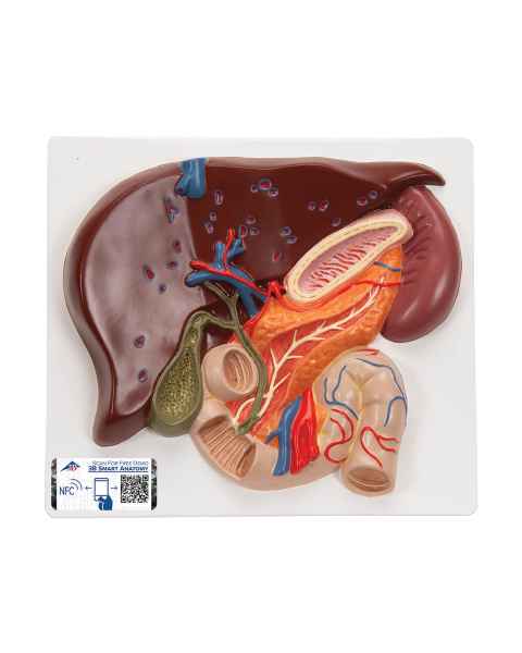 3B Scientific VE315 Liver with Gall Bladder Pancreas and Duodenum Model