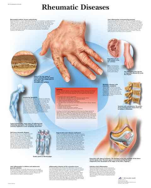 Rheumatic Diseases Chart