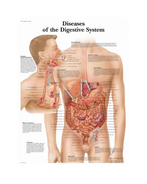 Diseases Digestive System Chart