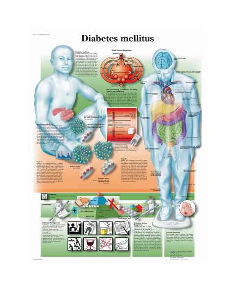 Diabetesmellitus Chart