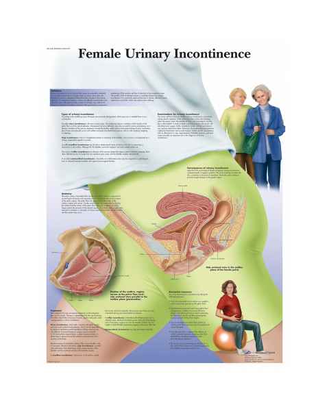 Female Urinary Incontinence Chart