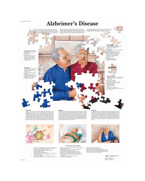 Alzheimer's Disease Chart