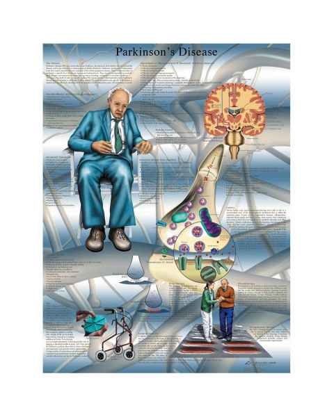 Parkinson's Disease Laminated Chart - English
