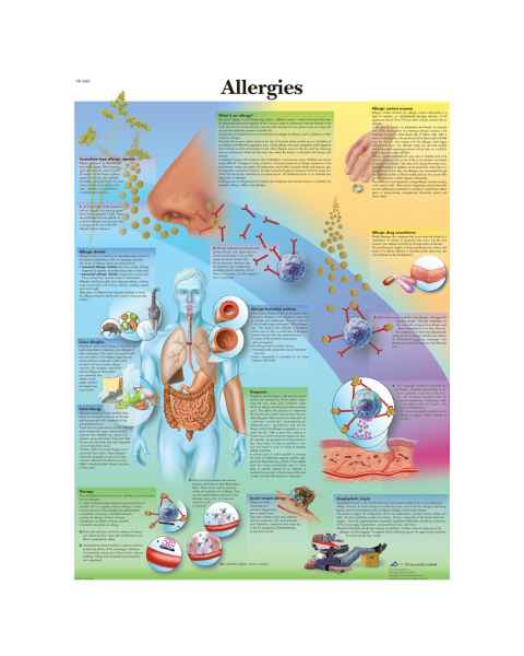 Allergies Chart