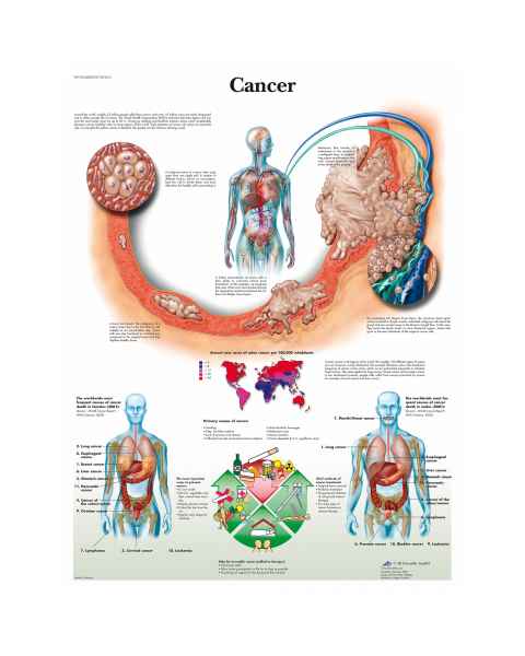 Cancer Chart