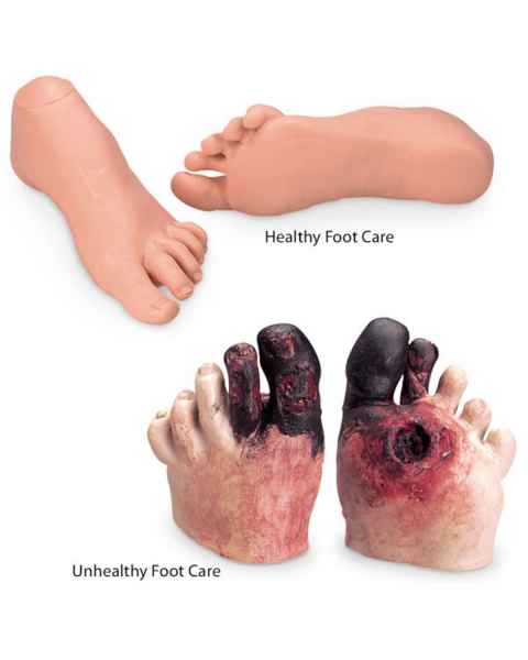 Life/form Healthy and Unhealthy Foot Care Set