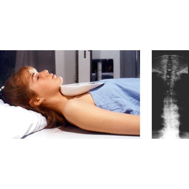 Boomerang XRay Filters by Octostop