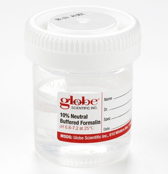 60mL Tite-Rite Container Pre-Filled with 10% Neutral Buffered Formalin - Attached Hazard Label