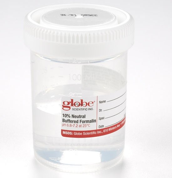 120mL Tite-Rite Container Pre-Filled with 10% Neutral Buffered Formalin - Attached Hazard Label