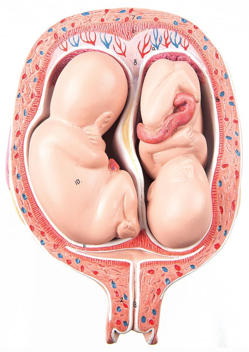 5th Month Twin Fetus Model - Normal Position