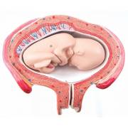 5th Month Fetus Model - Breech Position