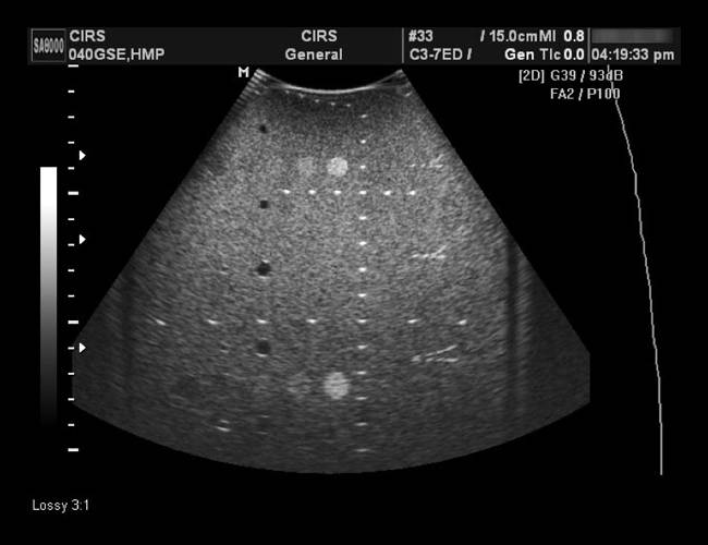 CIRS Multi Purpose Multi Tissue Ultrasound Phantom
