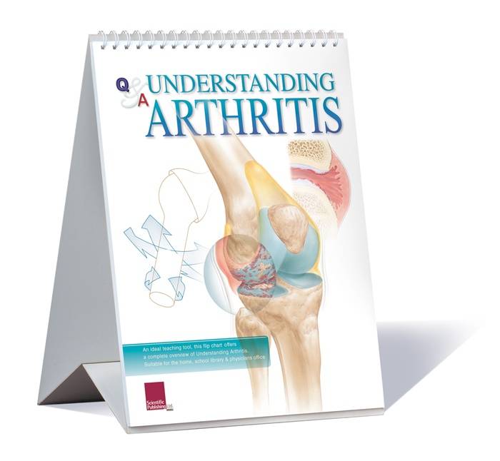 Scientific Publishing 1052F Understanding Arthritis Flip Chart