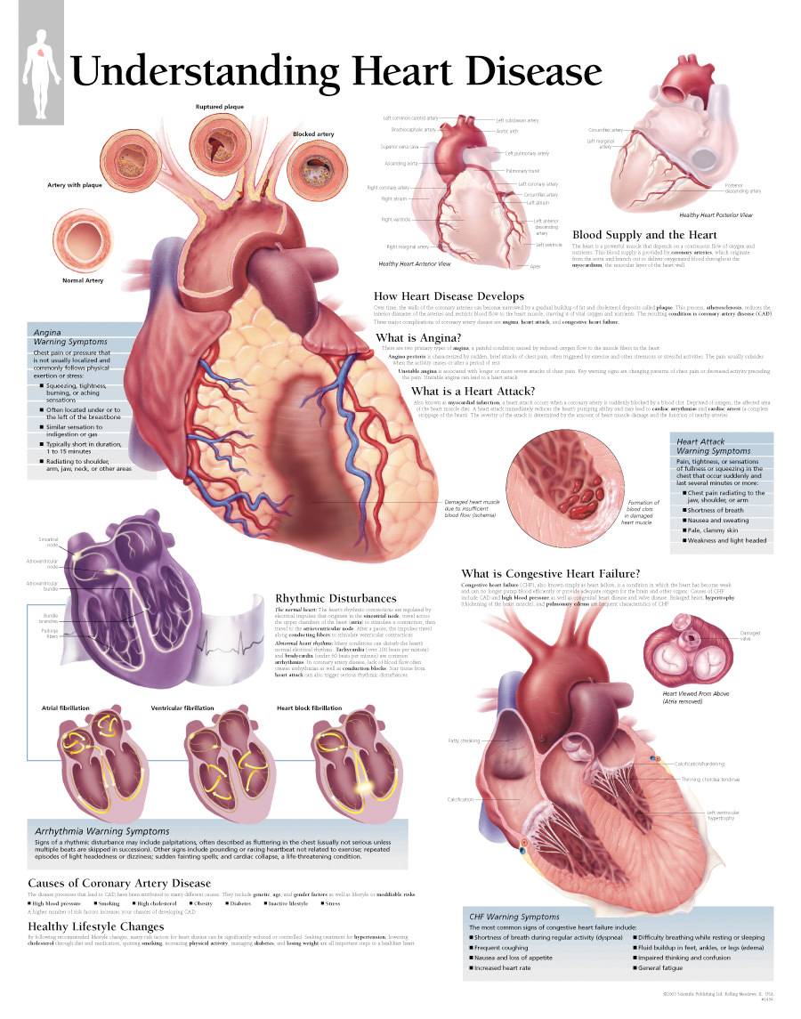 Scientific Publishing Understanding Heart Disease Chart