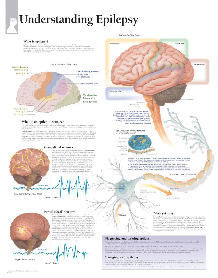 Scientific Publishing Understanding Epilepsy Chart