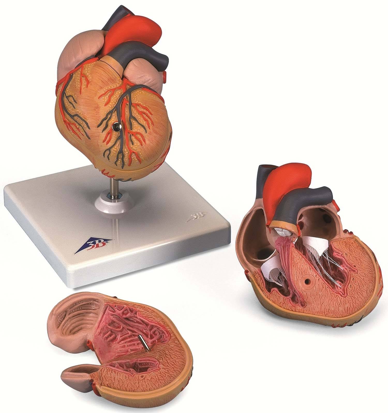 3B Scientific G04 Heart Model with Left Ventric Hypertrophy 2Part