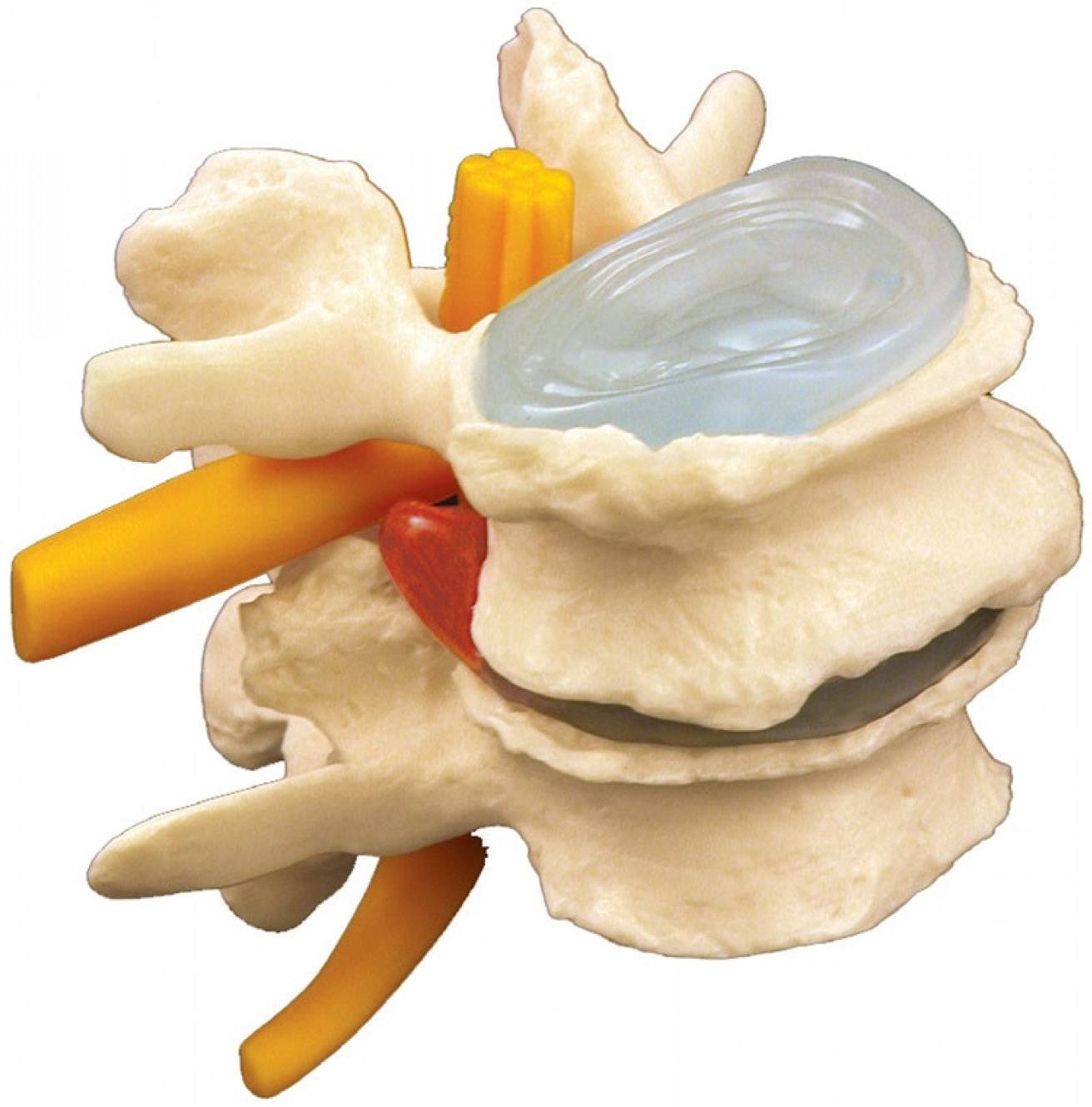 Four Stage Vertebrae Model GPI 1760