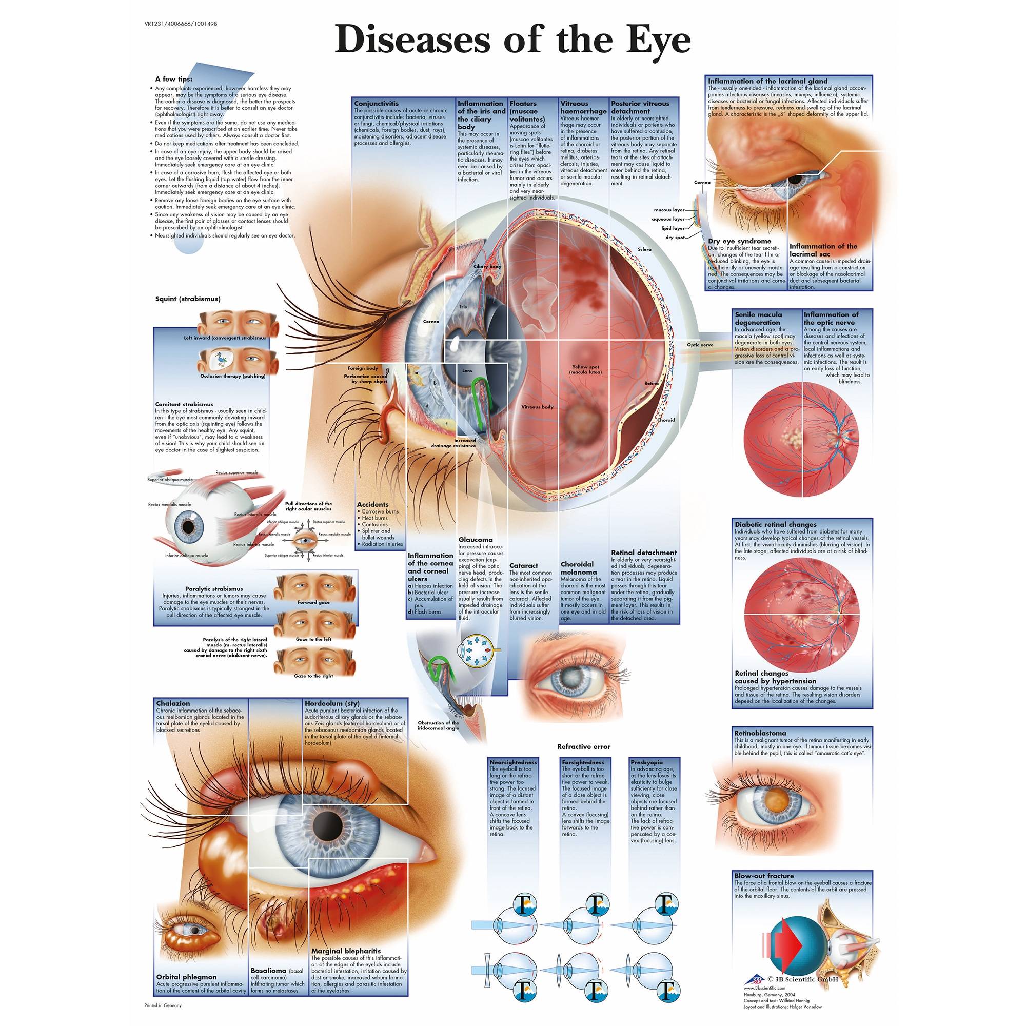 3B Scientific Diseases of the Eye Chart