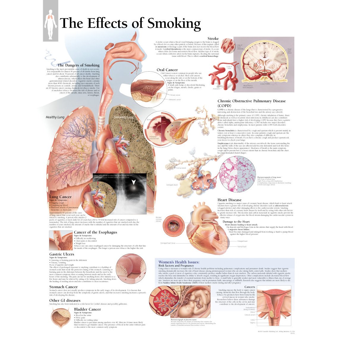 effects of smoking expository essay