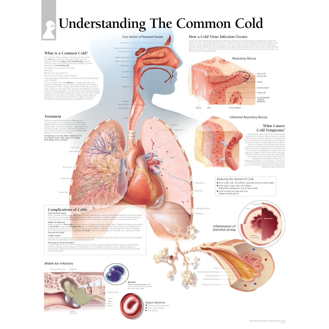 Scientific Publishing 1450F Understanding Hypertension Flip Chart