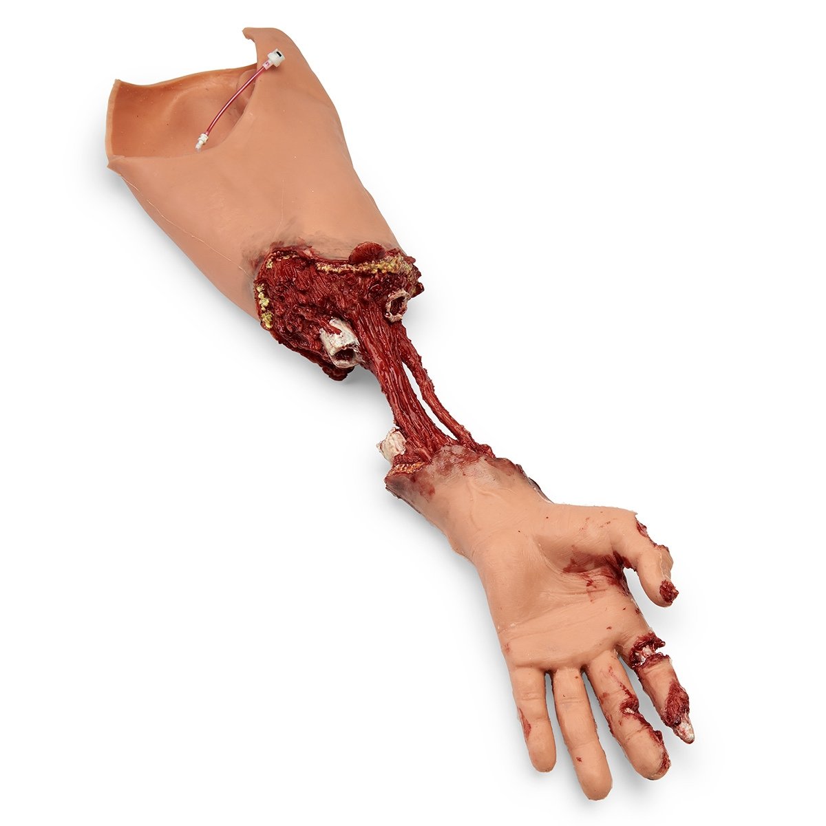 101-481 Simulaids Xtreme Trauma Bleeding Arm for Advanced SMART STAT