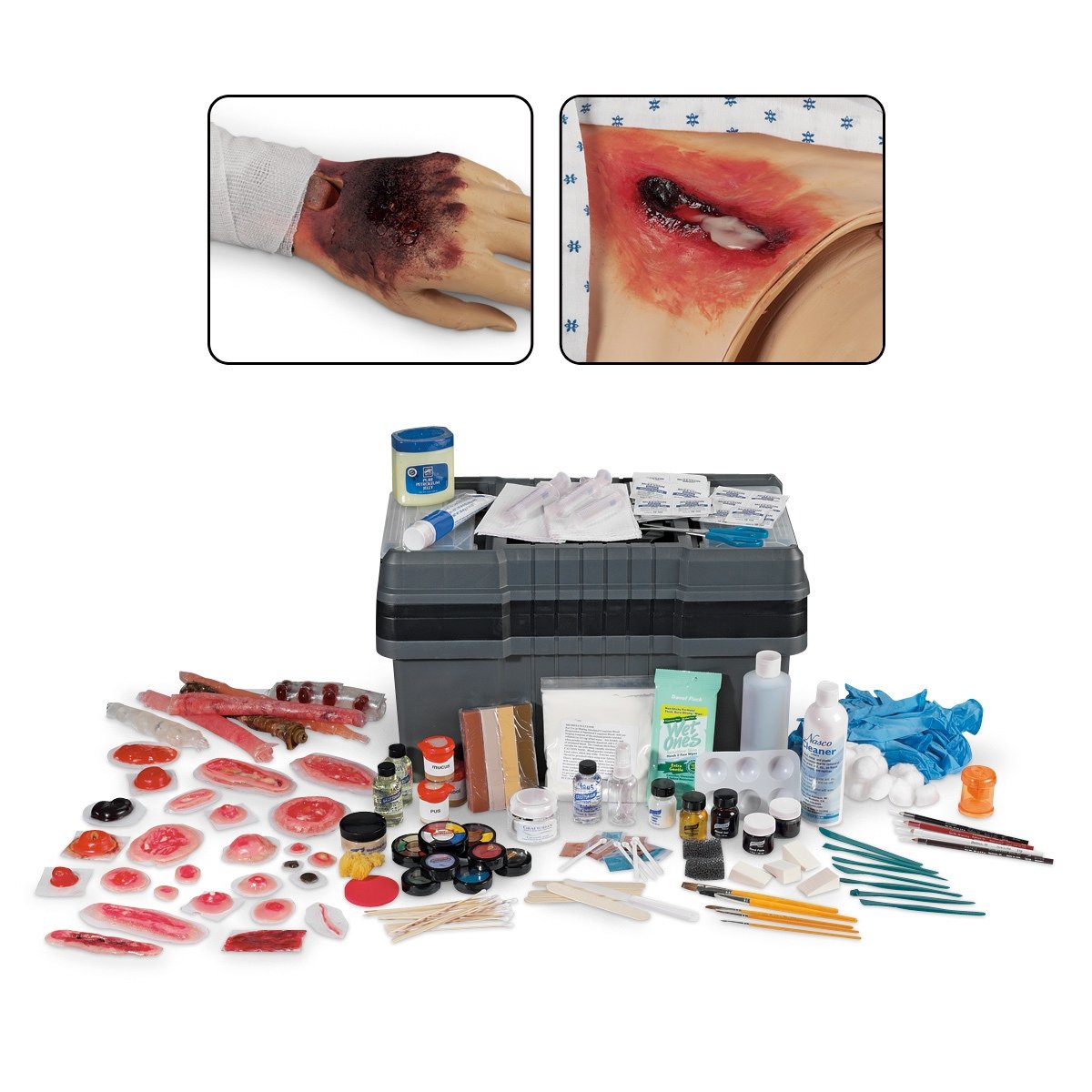 Simulaids Nursing Care Moulage Kit