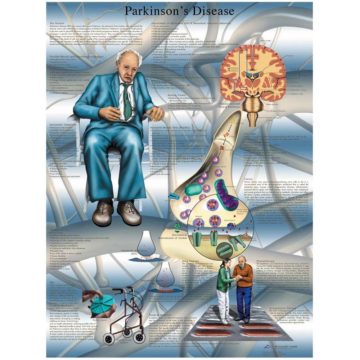 3B Scientific VR1629L Parkinson's Disease Chart English (Laminated)