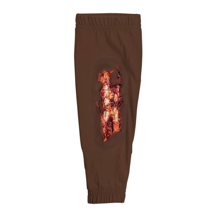 STOPS Medical 1025978 Radial/Ulna Open Fracture Sleeve - Dark Skin Tone