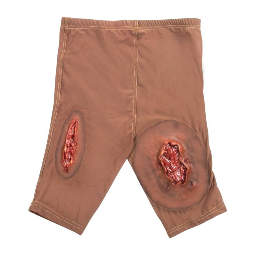 STOPS Medical 1025982 Multiple Large Femoral Wounds Sleeve Shorts - Dark Skin Tone