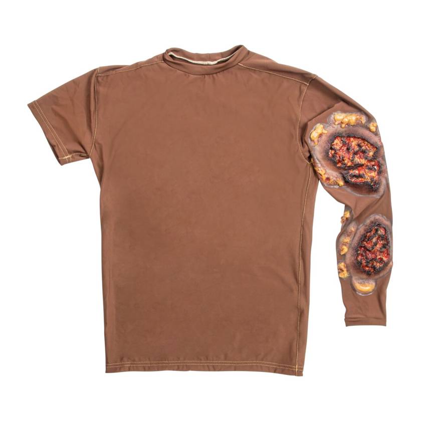 STOPS Medical 1025983 Full Thickness Arm Burn Long Sleeve Shirt, Dark Skin Tone - Front