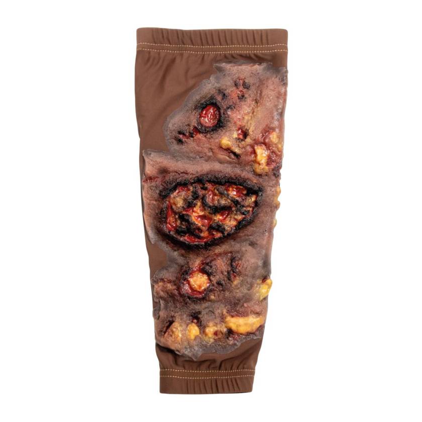 STOPS Medical 1025984 Full Thickness Lower Leg Burn Lower Leg Sleeve - Dark Skin Tone