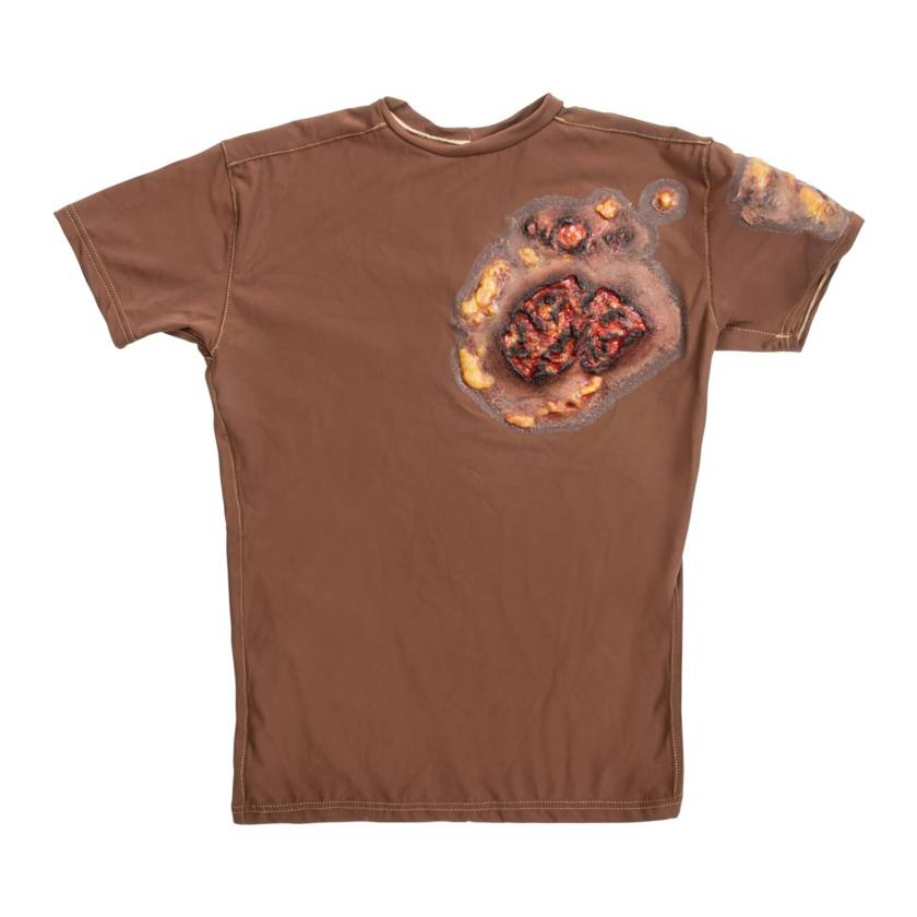 STOPS Medical 1025985 Full Thickness Chest and Back Burn Short Sleeve Shirt, Dark Skin Tone - Front