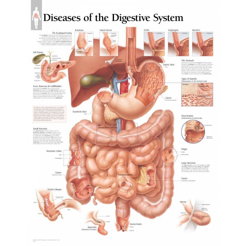 Diseases of the Digestive System Chart