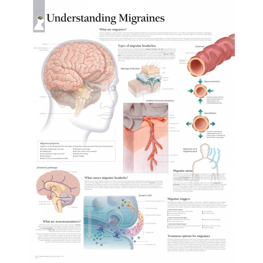Understanding Migraines Chart