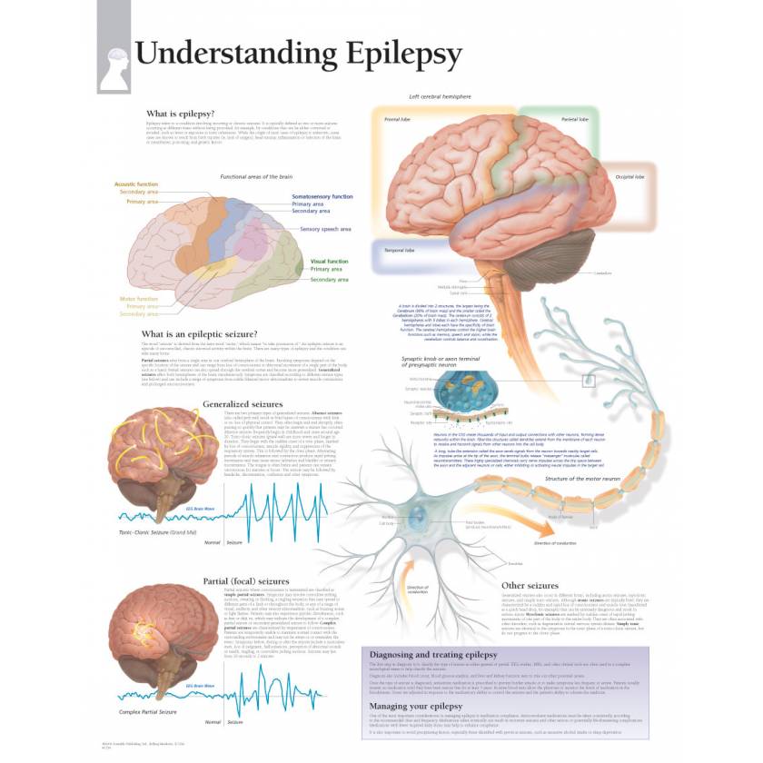 Understanding Epilepsy Chart