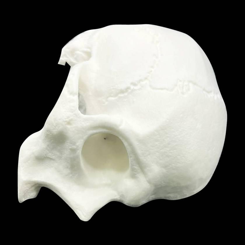 Bone Models™ 200800 Half Skull Surgical Practice Model, Front View