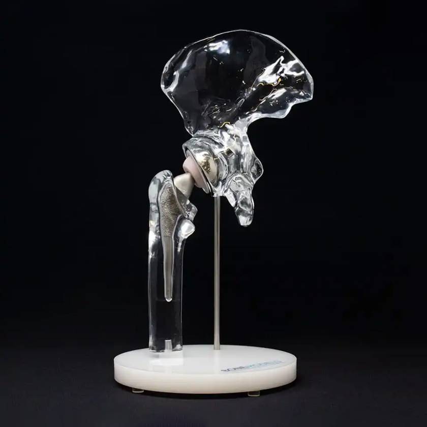 Bone Models™ 390200 Clear Hip Display Model with Generic Implant