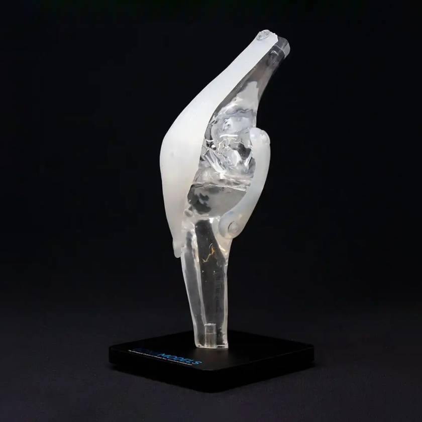 Bone Models™ 390300 Clear Anatomical Knee Display Model