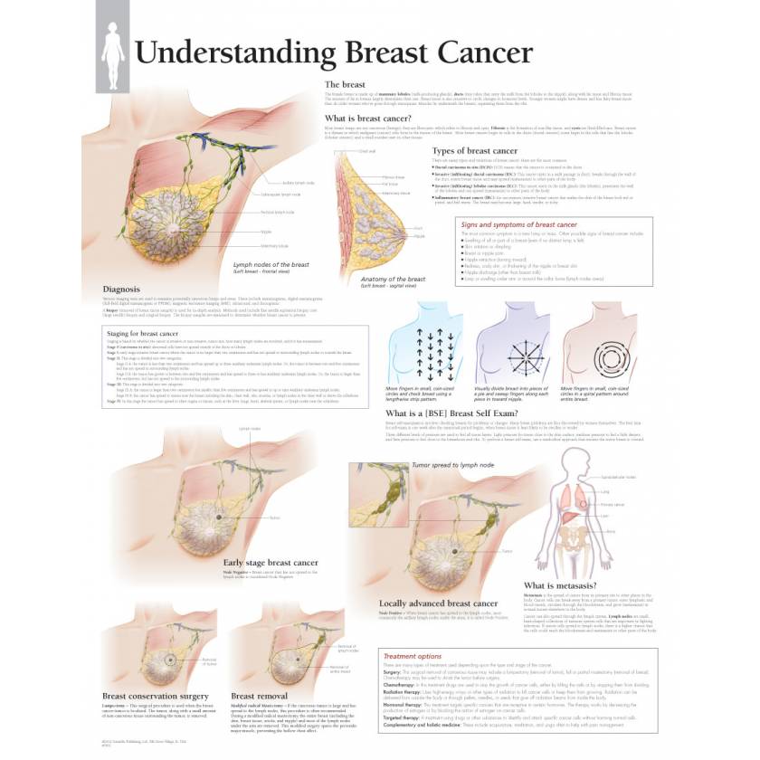 Female Breast Exam-Room Anatomy Posters