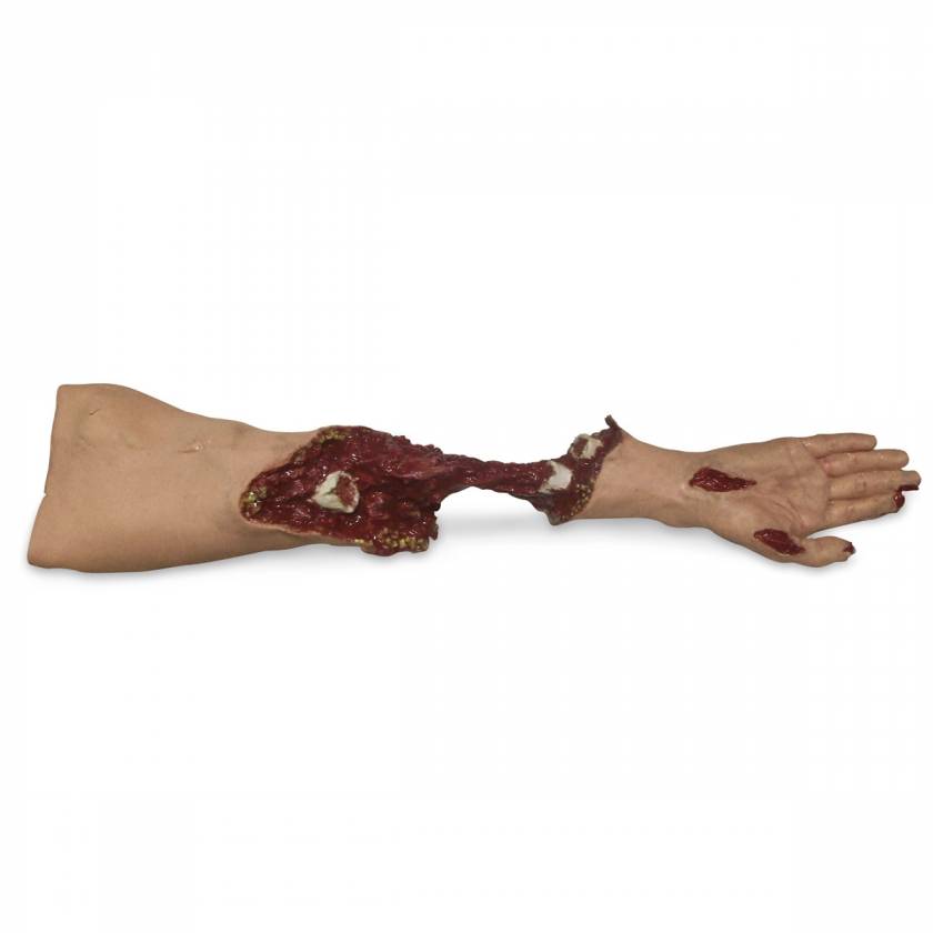 Xtreme Trauma Moulage Arm Simulator