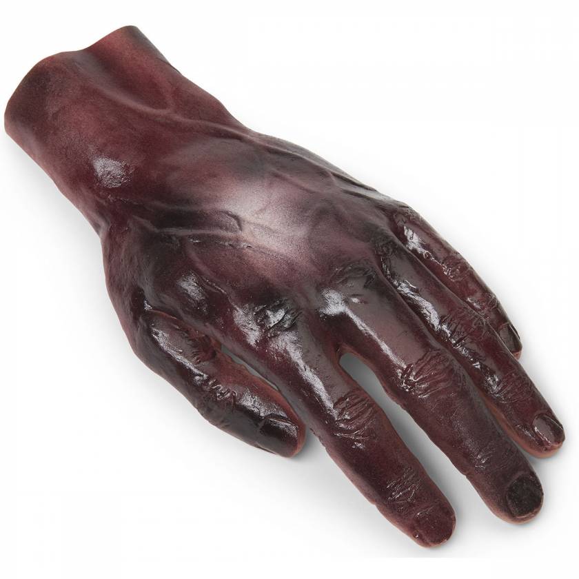 Life/form Moulage Wound - Burn - Hand - 2nd/3rd Degree - Light Simulator