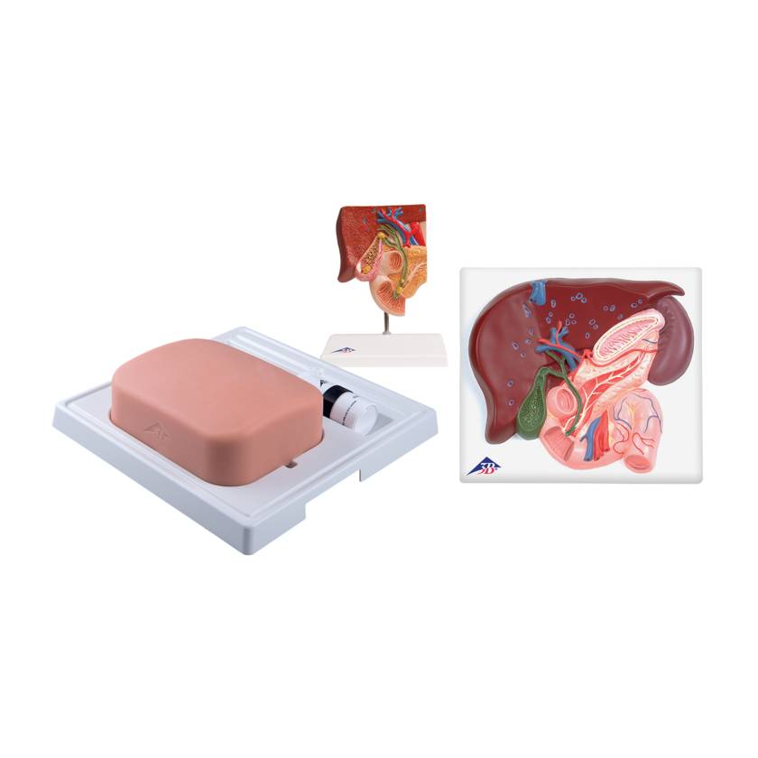 3B Scientific 8000884 Gallbladder Set