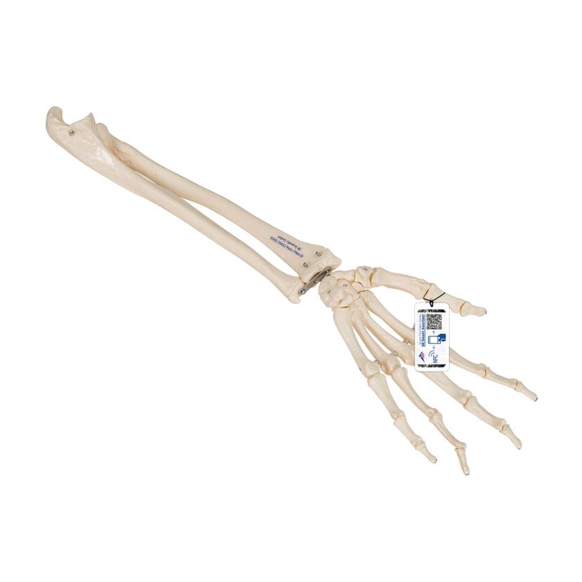 3B Scientific A40/3 Loose Hand Skeleton with Portions of Ulna and Radius
