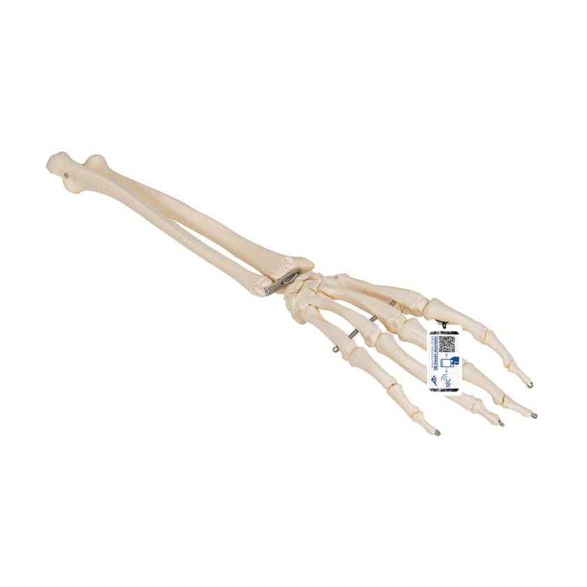 3B Scientific A41 Hand Skeleton With Portions of Ulna and Radius, Wire Mounted
