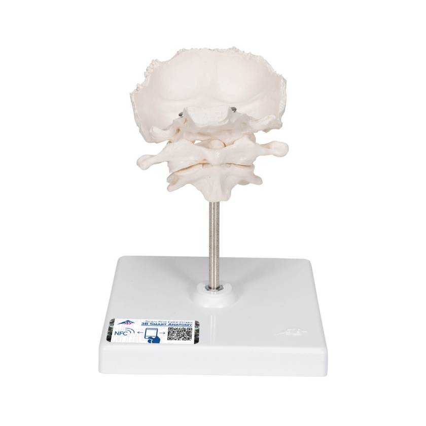 3B Scientific A75-1 Atlas and Axis with Occipital Plate on Stand - 3B Smart Anatomy