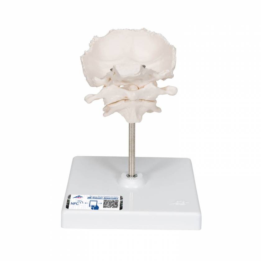 Atlas and Axis with Occipital Plate on Stand - 3B Smart Anatomy