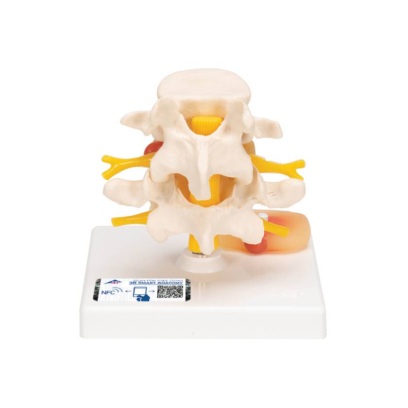 3B Scientific A76 Lumbar Vertebrae Teaching Model - 3B Smart Anatomy