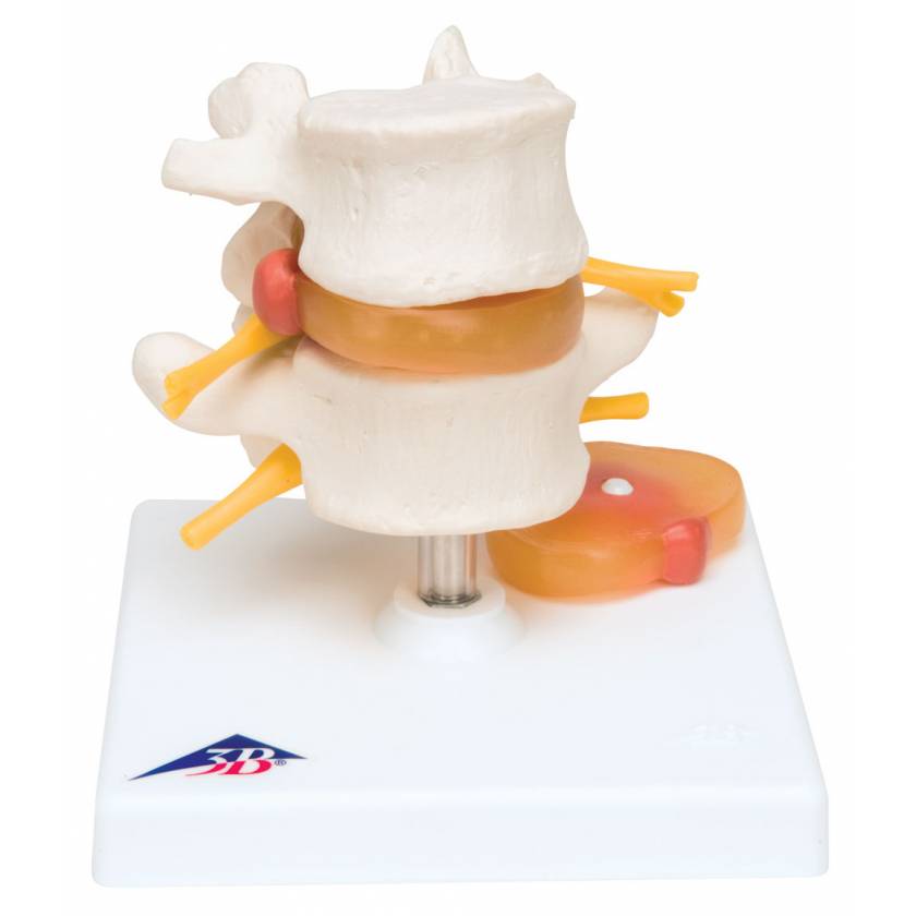 Lumbar Vertebrae Teaching Model